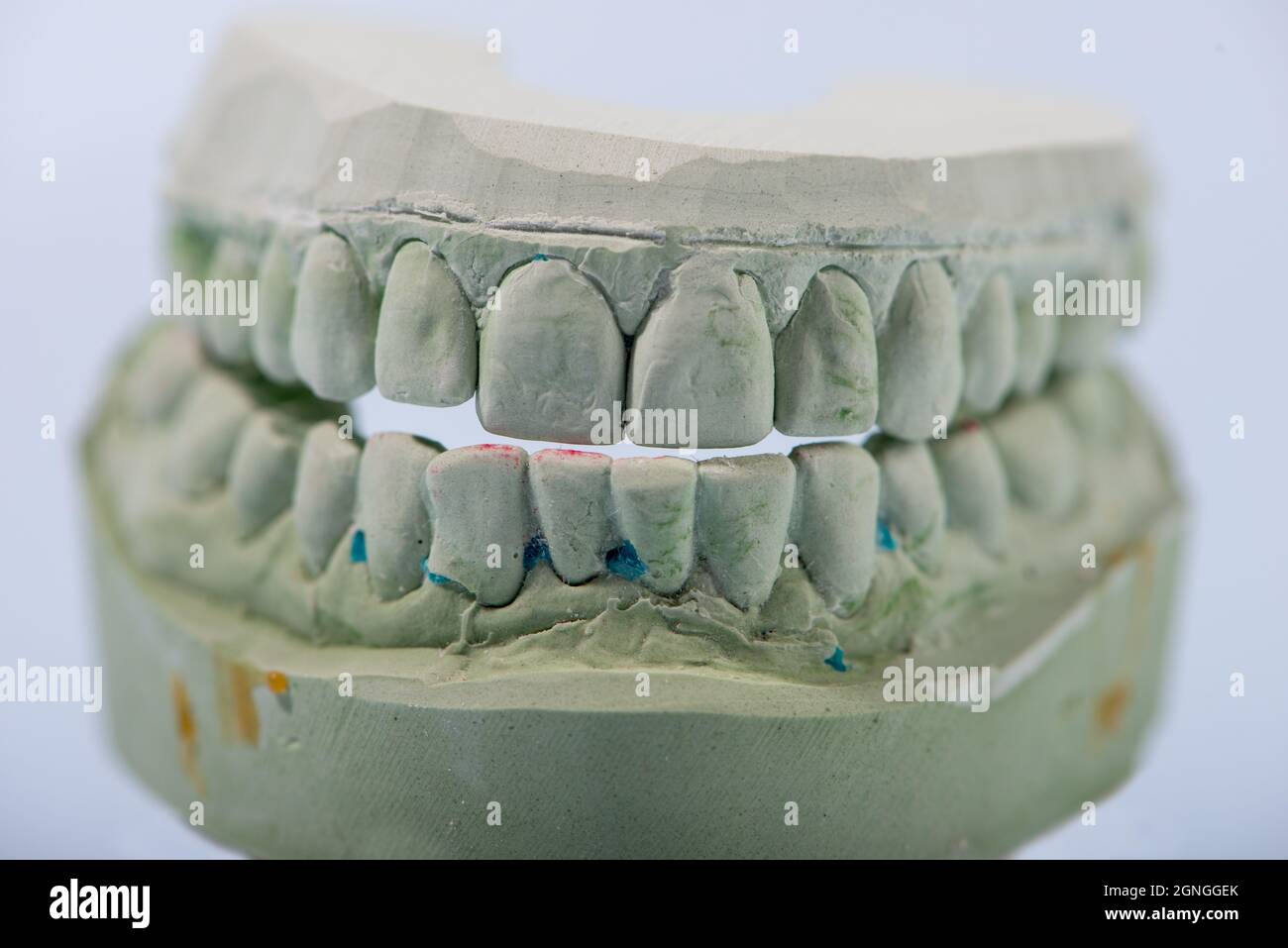 Gypsum Dental model of human teeth. Close up Stock Photo Alamy