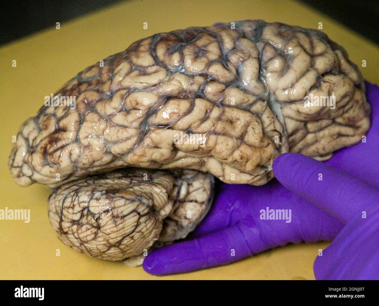 Technician holds hemisphere of human brain, which has been treated with formalin for preservation, before storage in brain bank for medical research Stock Photo