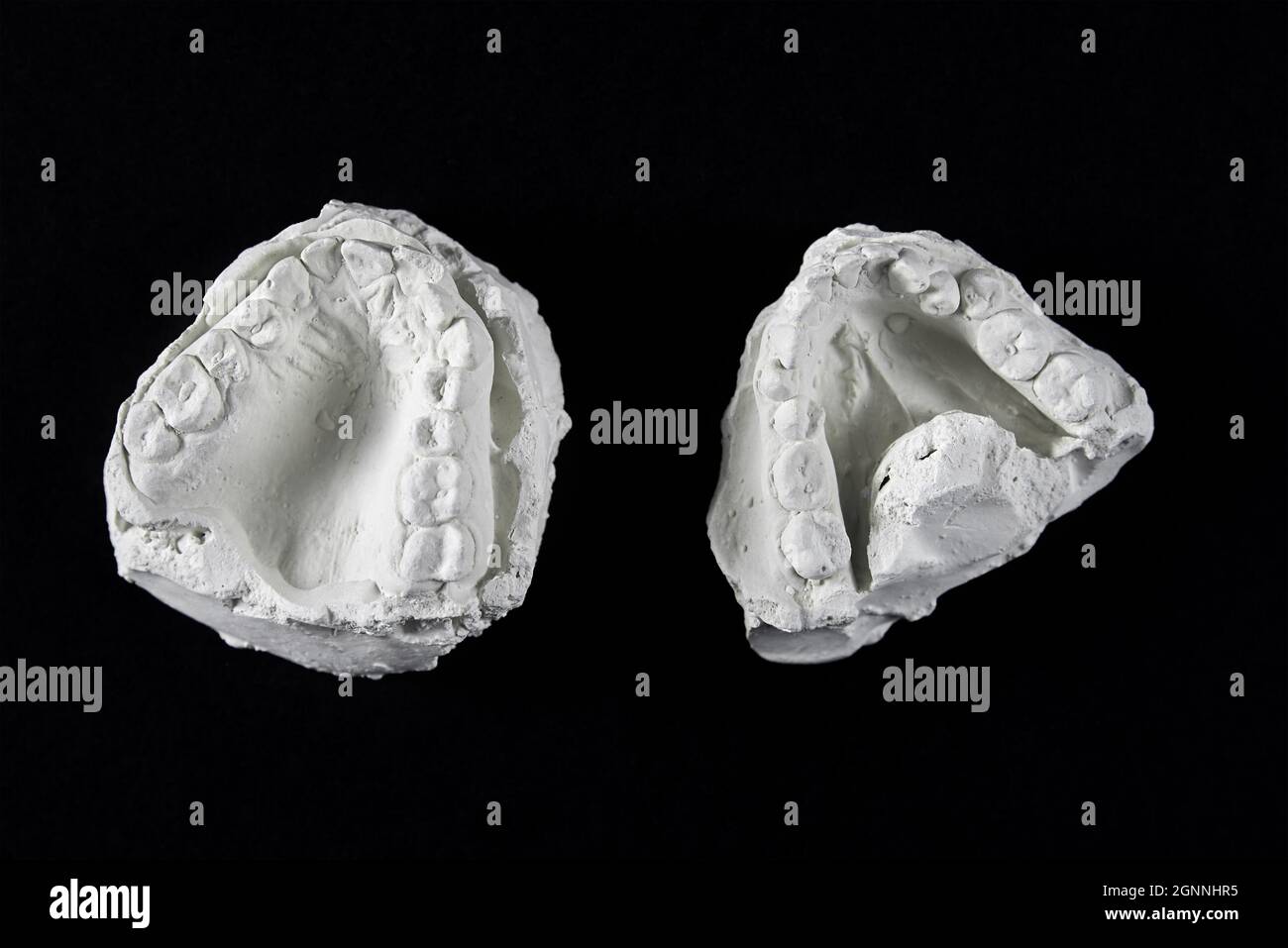Cast of the jaw made of plaster on black background. Teeth cast for