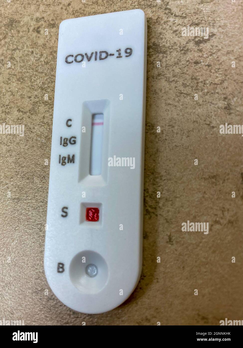A COVID-19 antibody test showing negative results for antibodies for both previous infection and the vaccine. Stock Photo