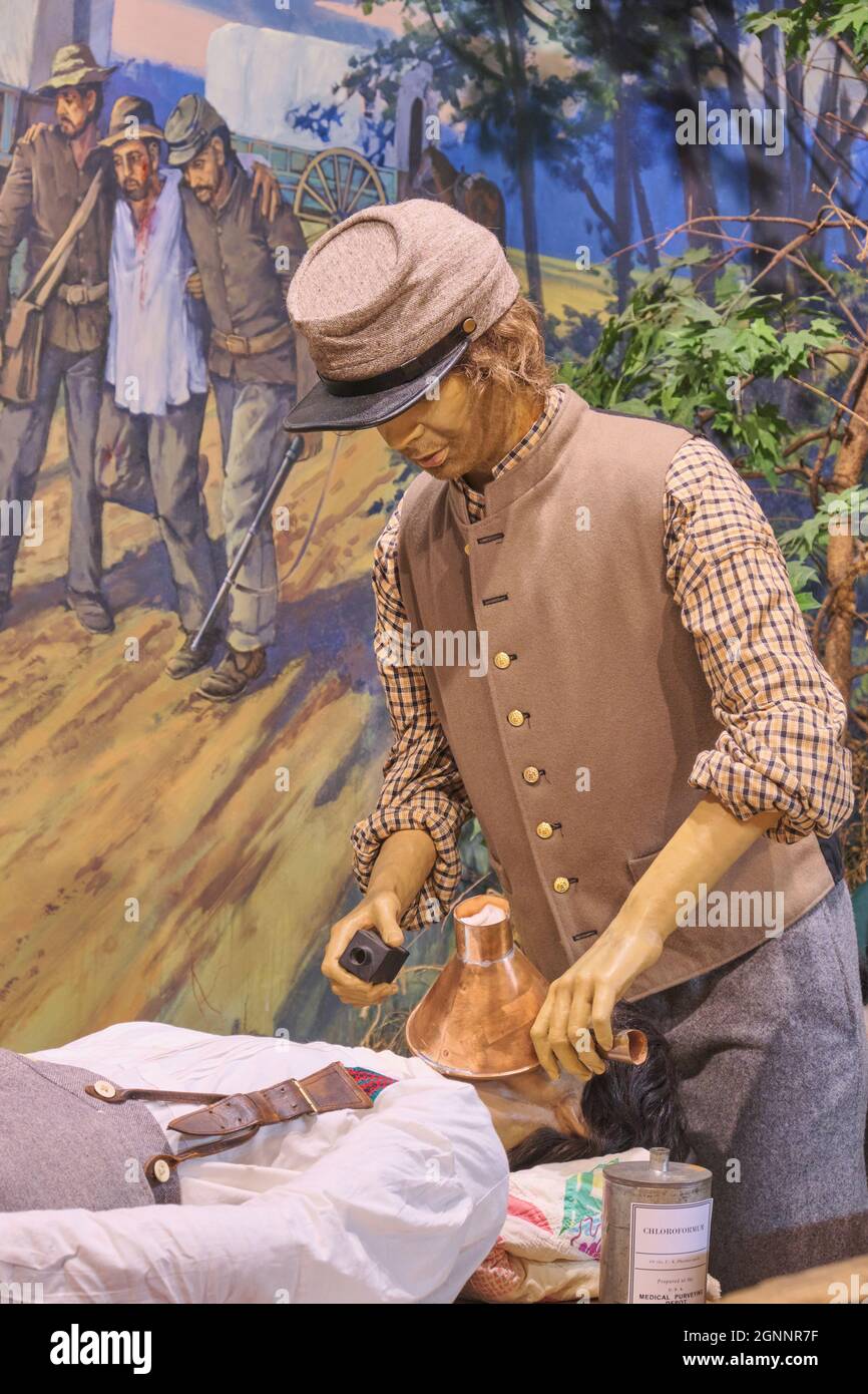 Applying chloroformum anesthesia for an operation. At the National Civil War Medicine Museum in Frederick, Maryland. Stock Photo