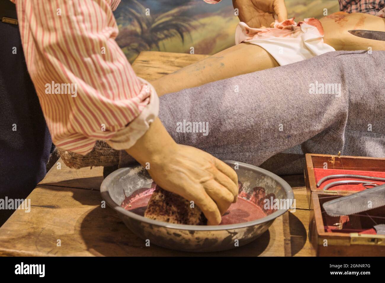 A field operation on a makeshift door. At the National Civil War Medicine Museum in Frederick, Maryland. Stock Photo