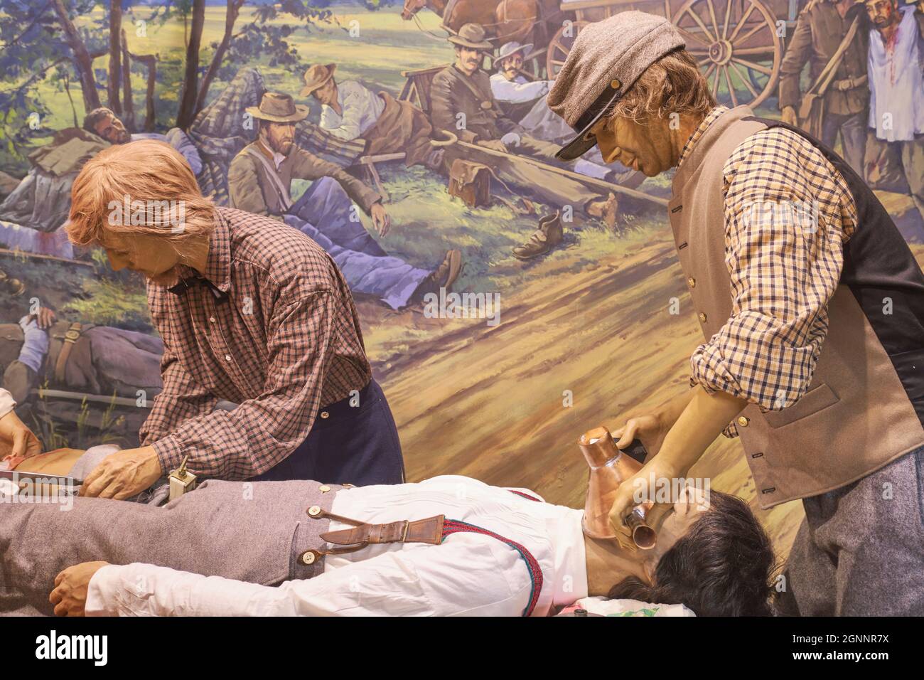Applying chloroformum anesthesia for an operation. At the National Civil War Medicine Museum in Frederick, Maryland. Stock Photo