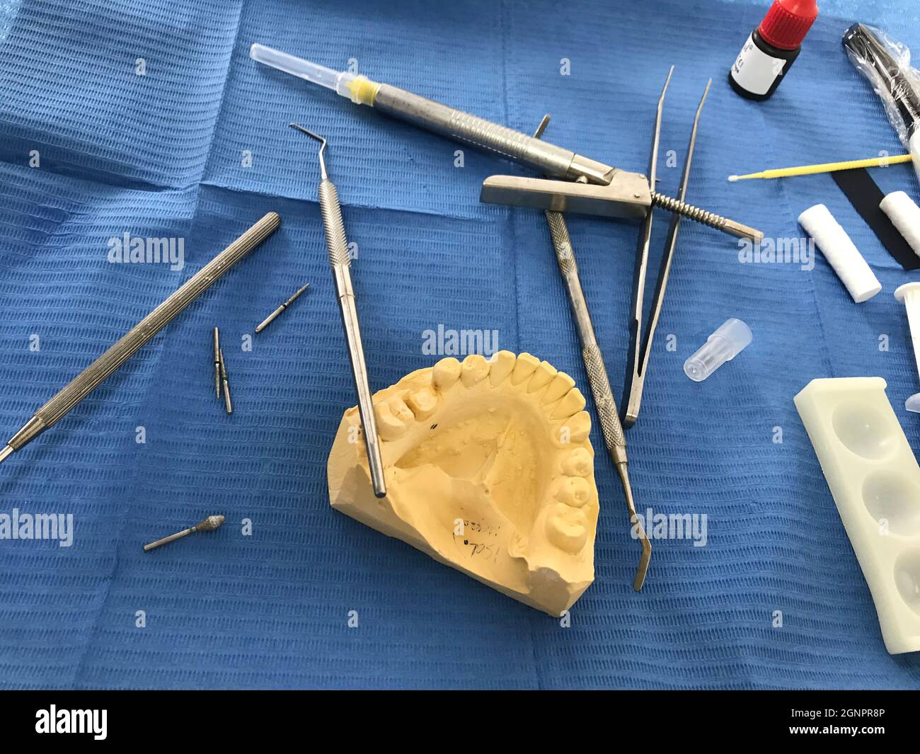 Plaster cast of teeth in the table of work of the dental technician