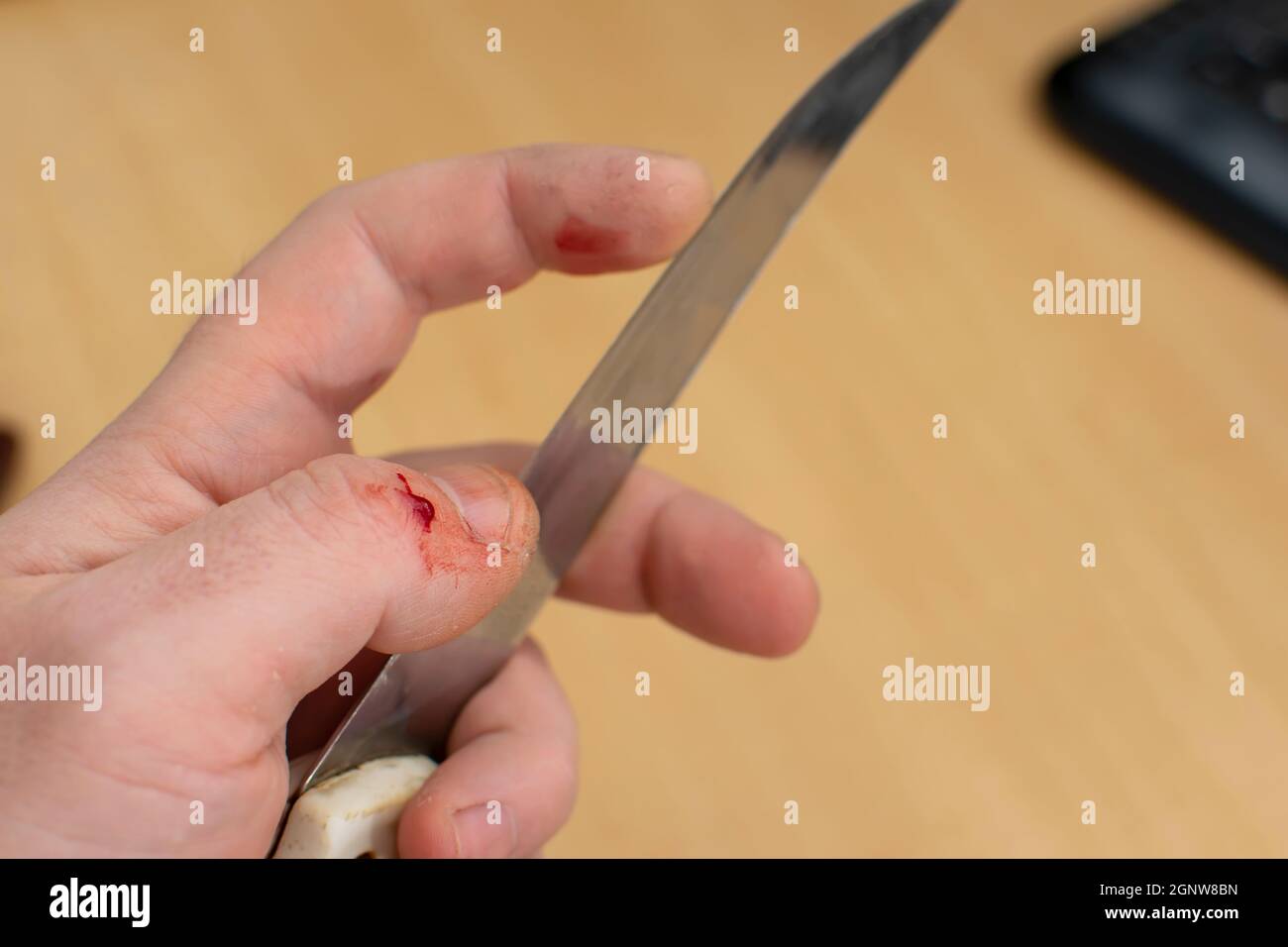 Hand cut blood online pic