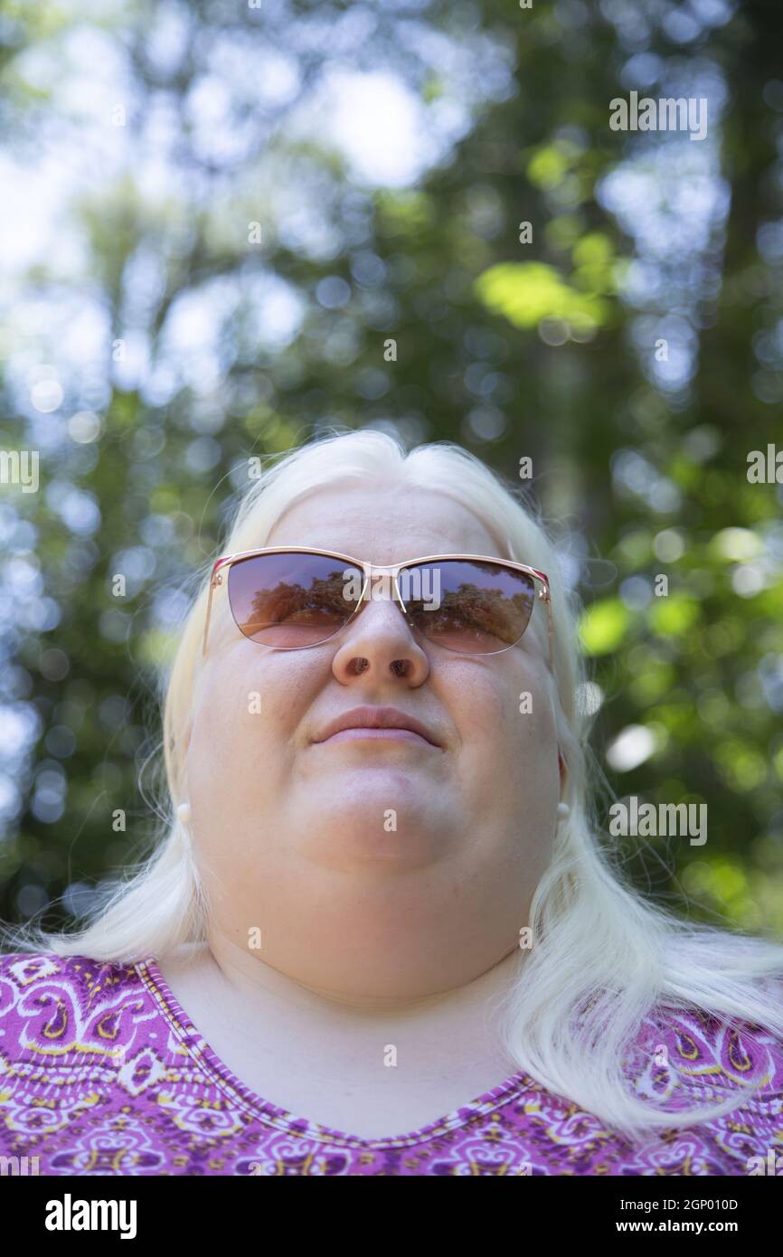 Albino woman hi-res stock photography and images - Alamy