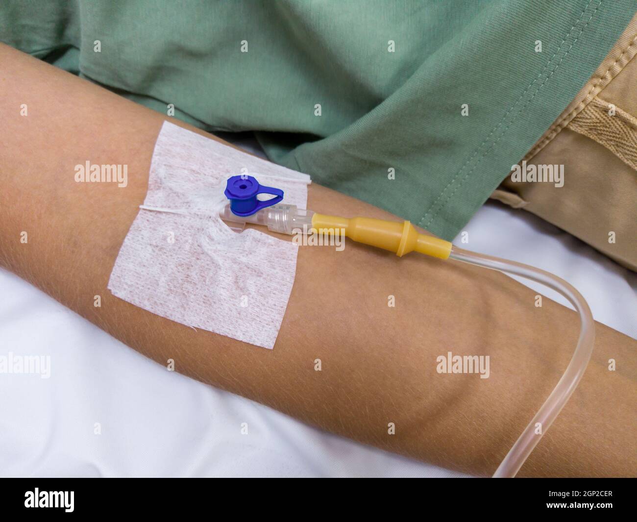 antibiotic medical dropper and needle inserted into a vein in the arm