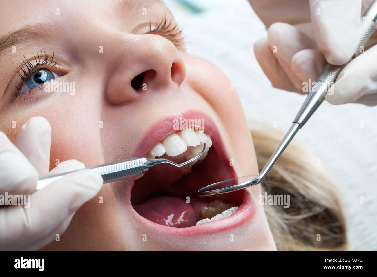 Macro close up of young child with open mouth at dentist Stock Photo