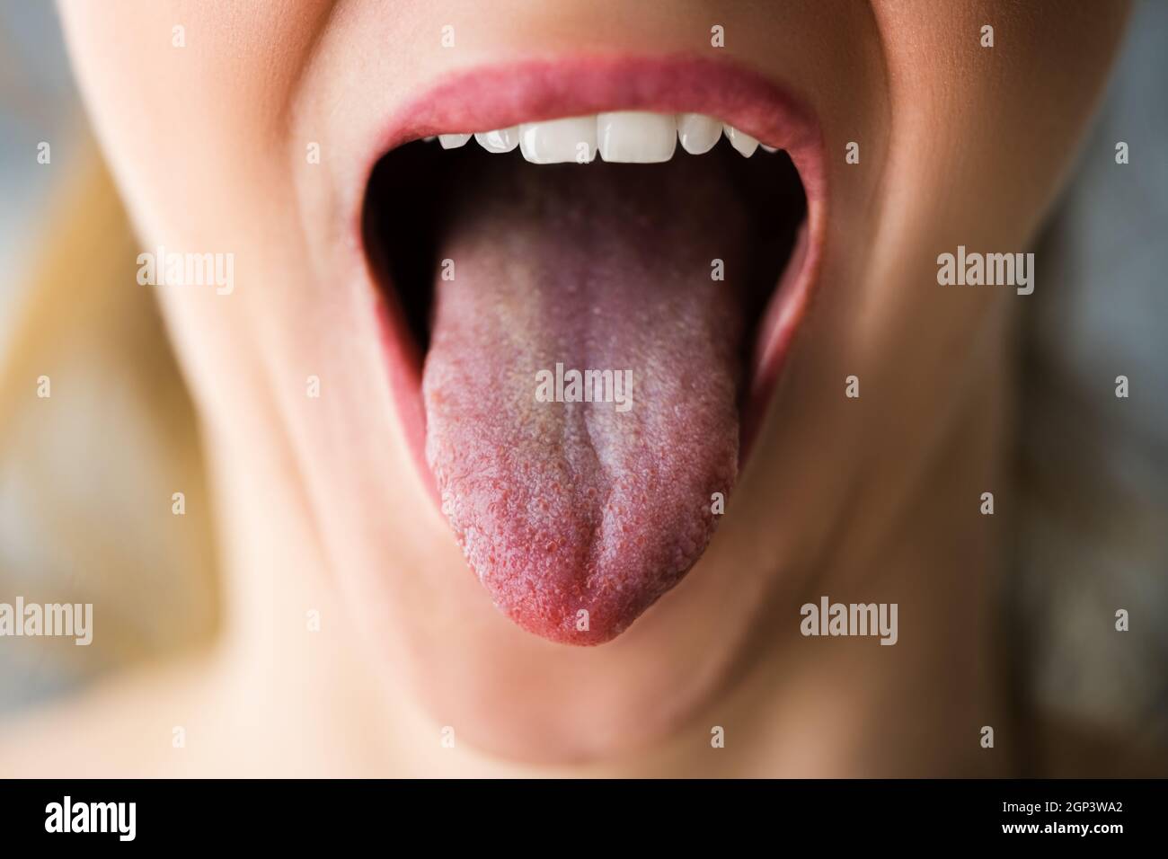 Healthy Woman Mouth With Clean Tongue Out Stock Photo Alamy