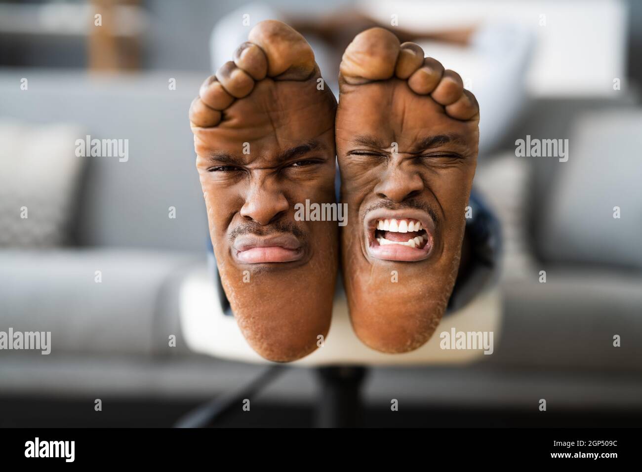 Feet Smell And Pain Expression. Sad Stinky African Foot Stock Photo Alamy