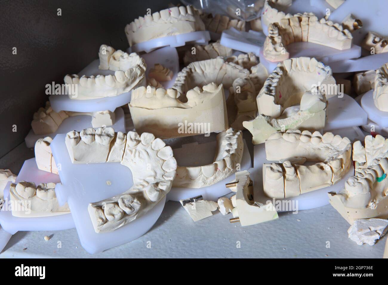 Impressions of teeth in the technical laboratory of the dental clinic