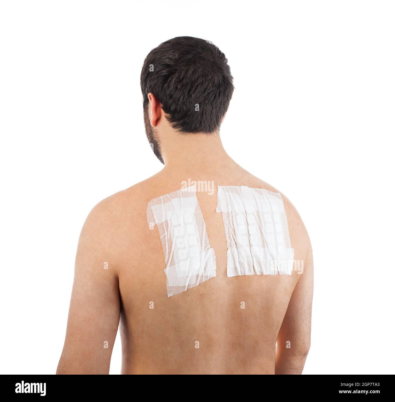 Skin Allergy Patch Test on Back of Male Patient On White Background Stock Photo