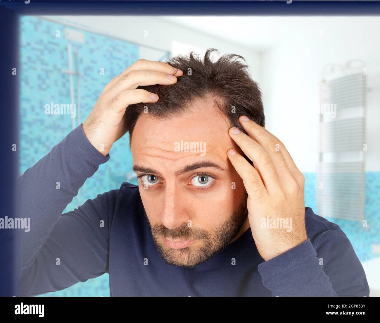 Caucasian young man controls hair loss in the bathroom Stock Photo