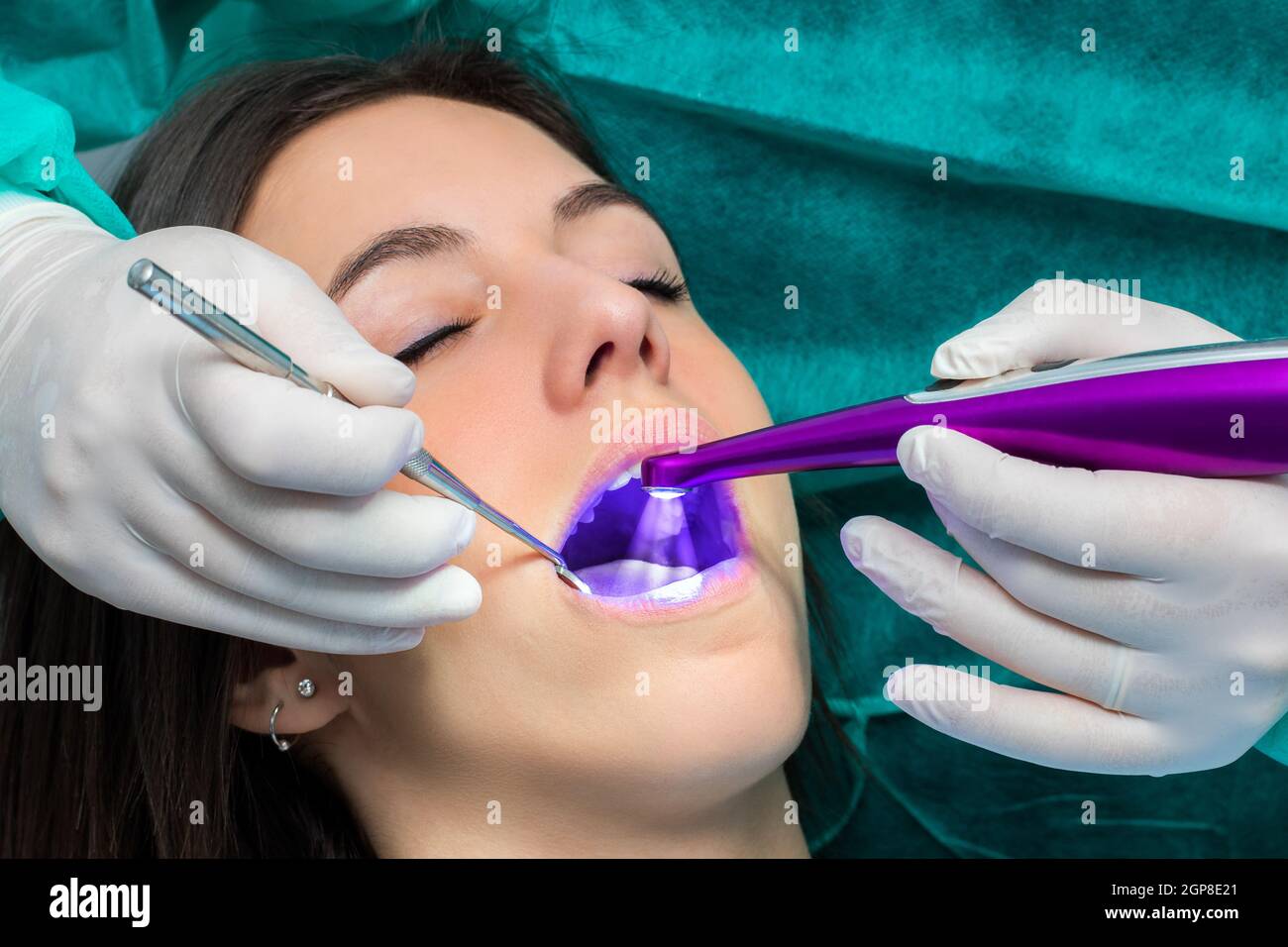 Macro close up of hand working on female teeth with blue led curing light. Stock Photo