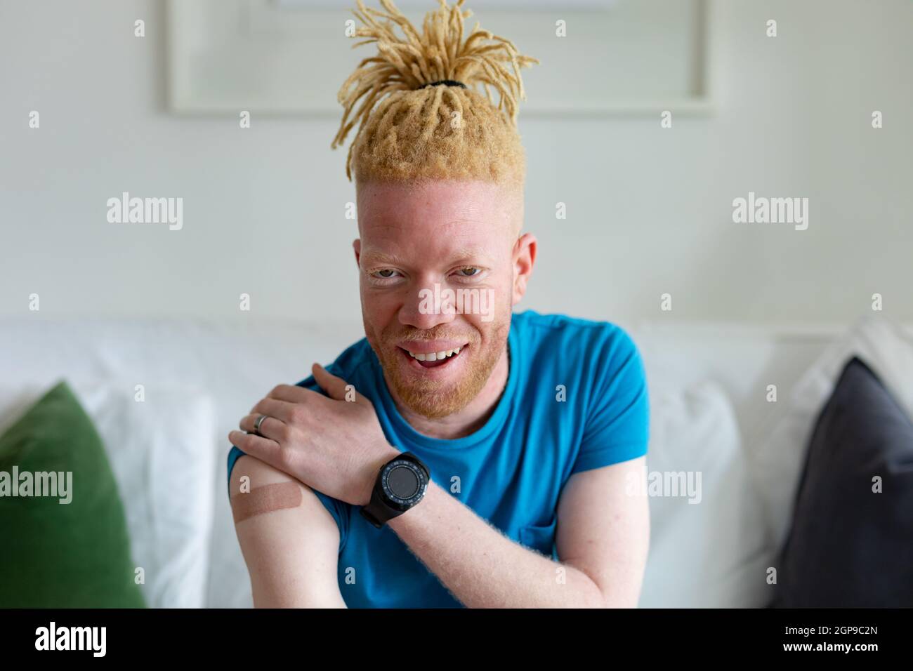 albino black person