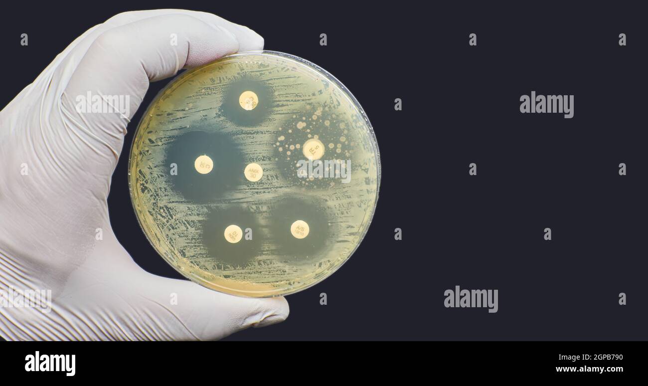 Kirby Bauer Antimicrobial susceptibility resistance diffusion test background Stock Photo