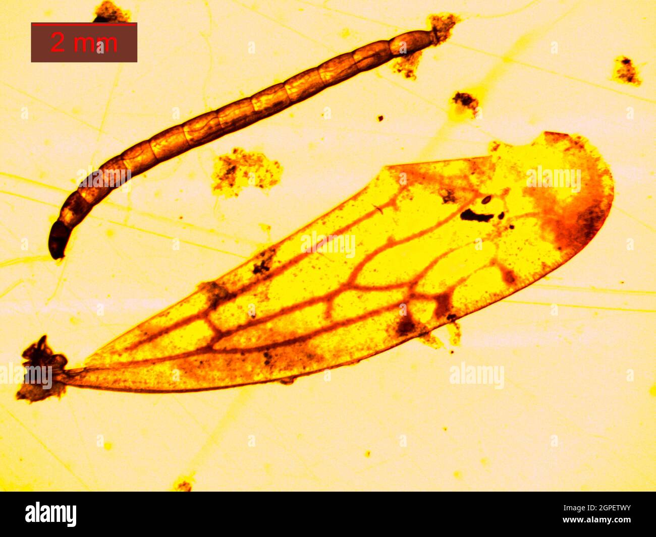 Mosquito Larva Under A Microscope. The Blood On Which Female Mosquitoes ...