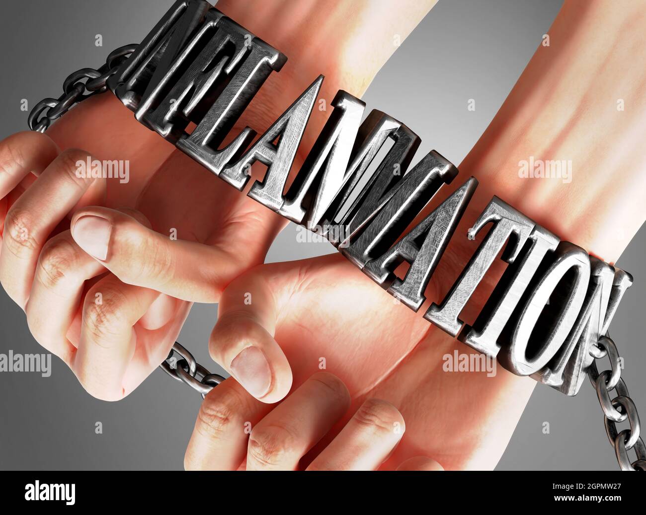 Social impact and influence of inflammation - analogy showing human hands in chains with a word inflammation as a symbol of its burden and misery it b Stock Photo