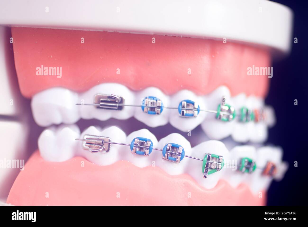 Dental teeth aligner bracket teaching student model showing gums and