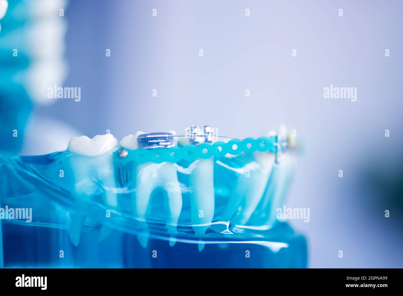 Dental teeth aligner bracket teaching student model showing gums and