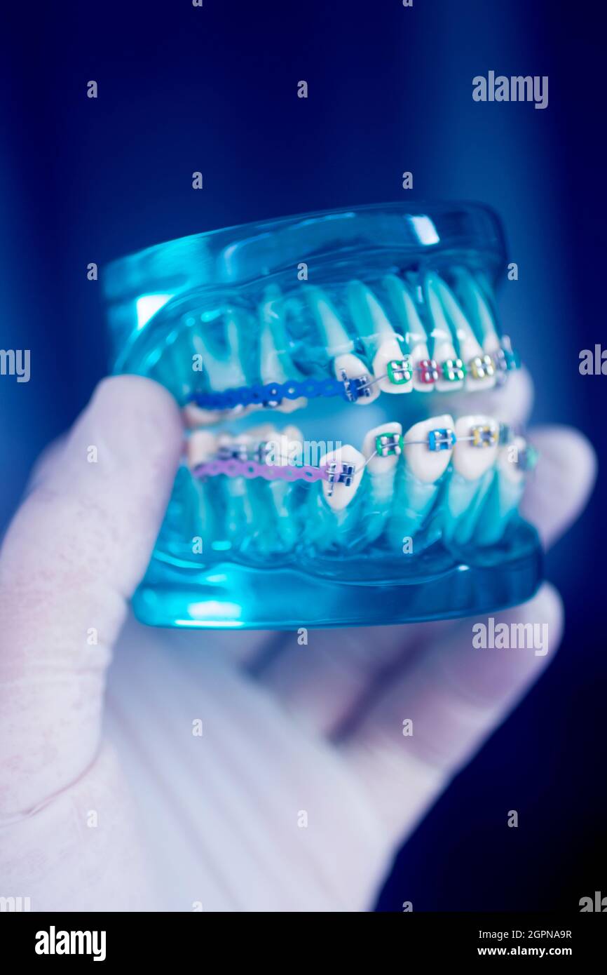 Dental teeth aligner bracket teaching student model showing gums and