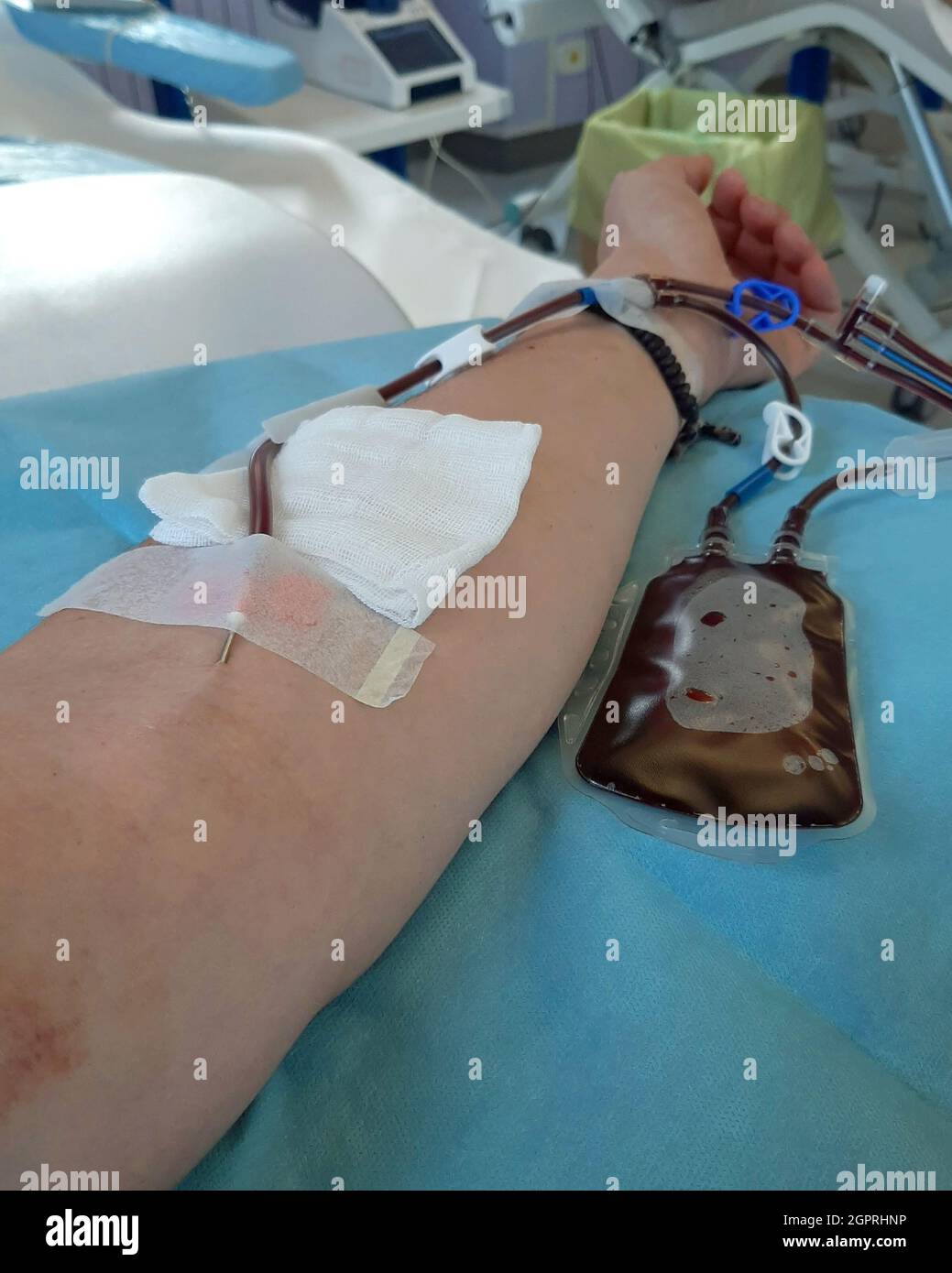 Giving Platelets volunteer adult arm during blood donation for platelet collection ...