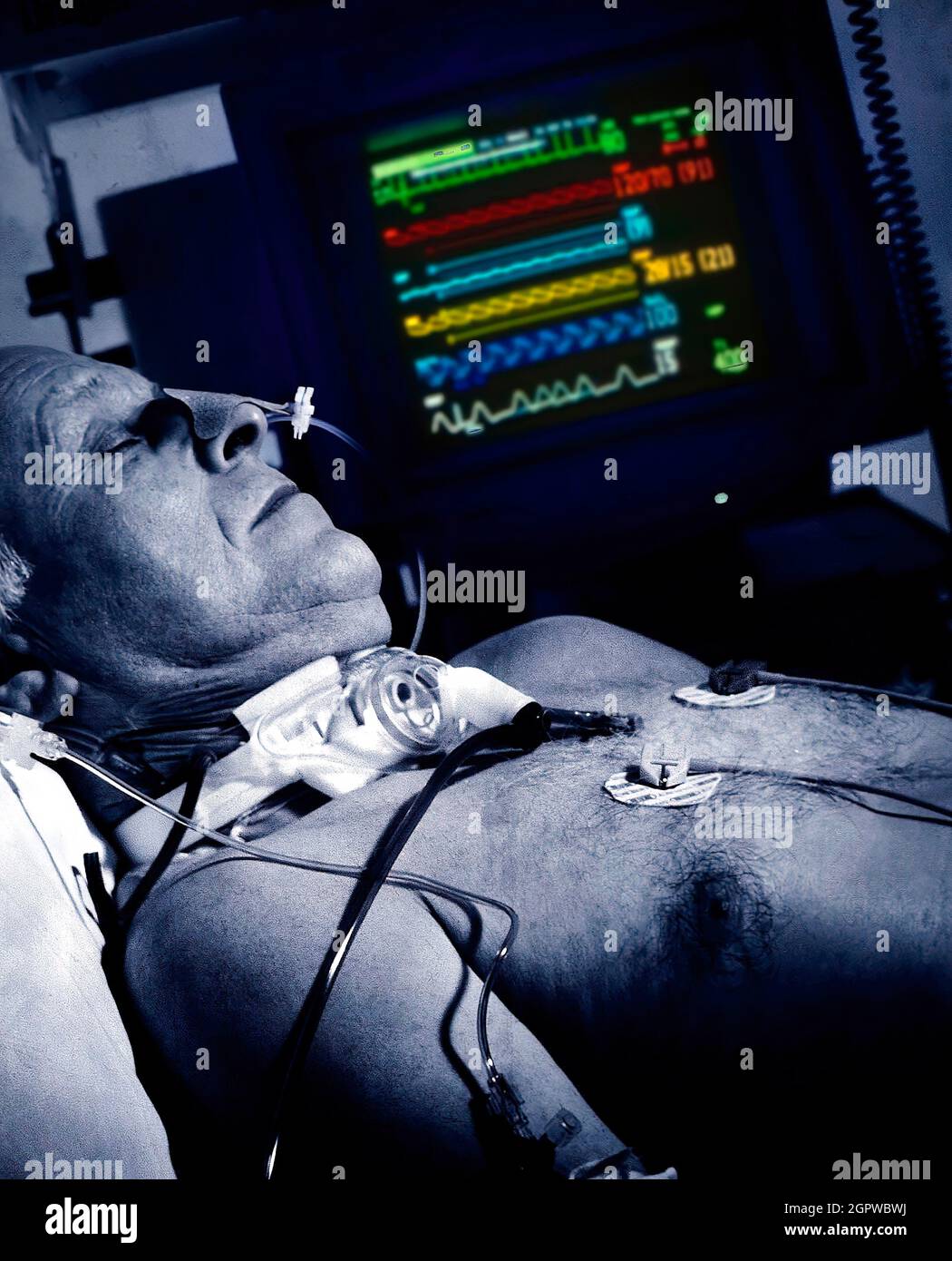 Patient in Intensive Care Unit (simulation) Stock Photo