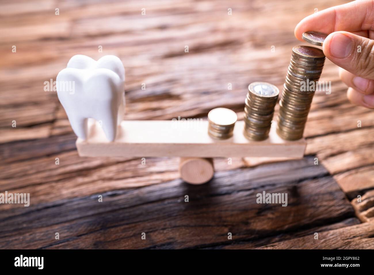 Dental Tooth Implant Cost. Teeth Insurance Money Stock Photo