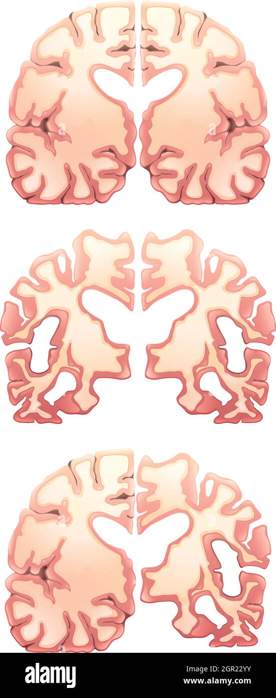 Brain Frontal Stock Vector Images Alamy