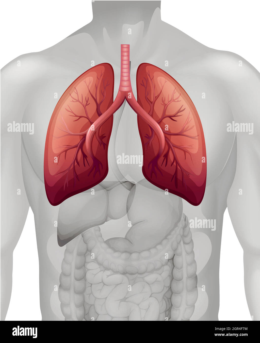 Lung cancer diagram in human Stock Vector