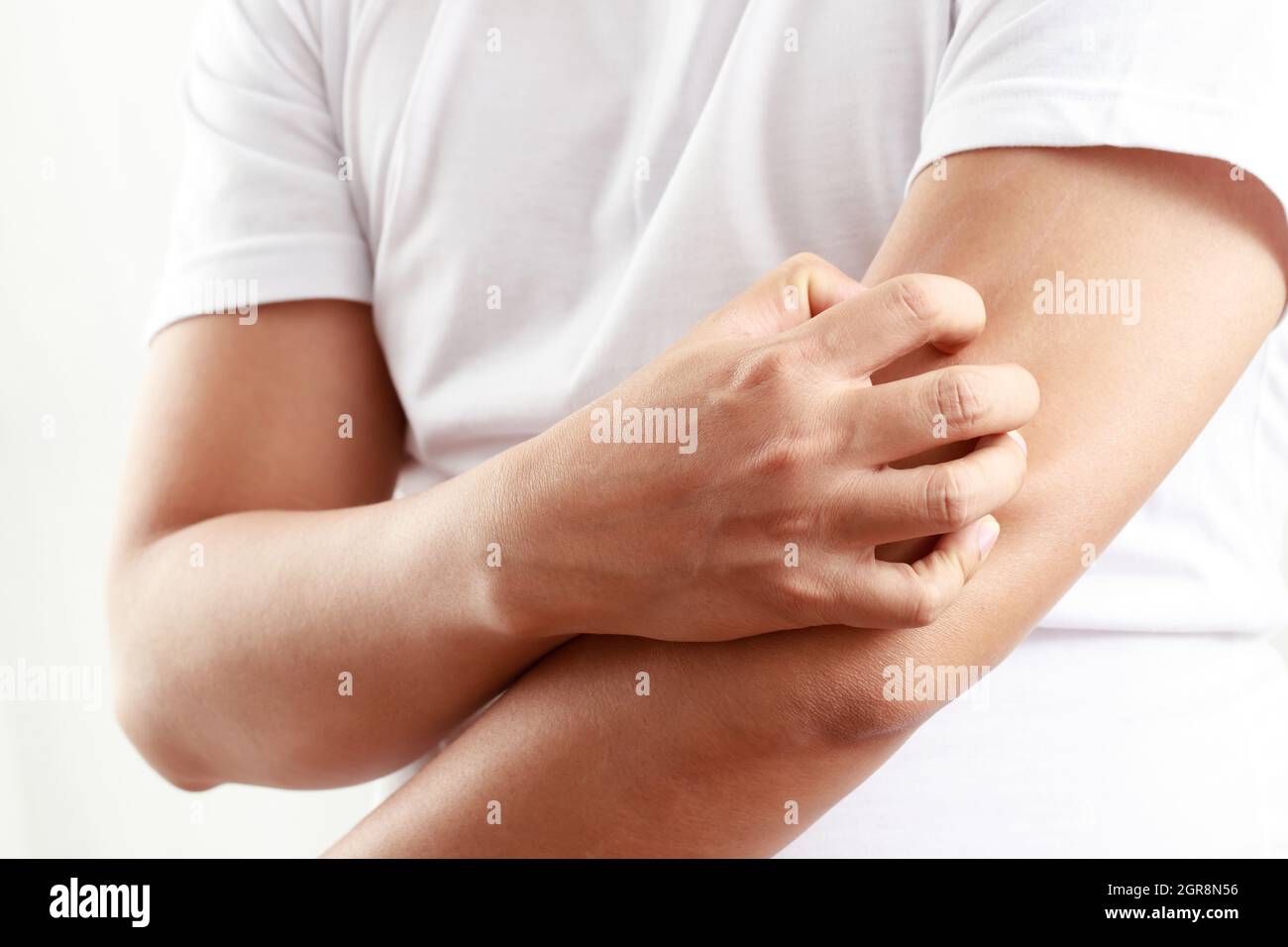 Itchy skin hi-res stock photography and images - Alamy