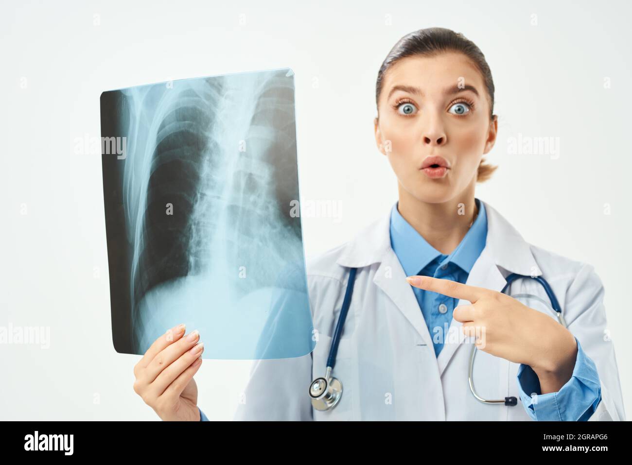 surprised radiologist showing x-ray emotion light background Stock ...