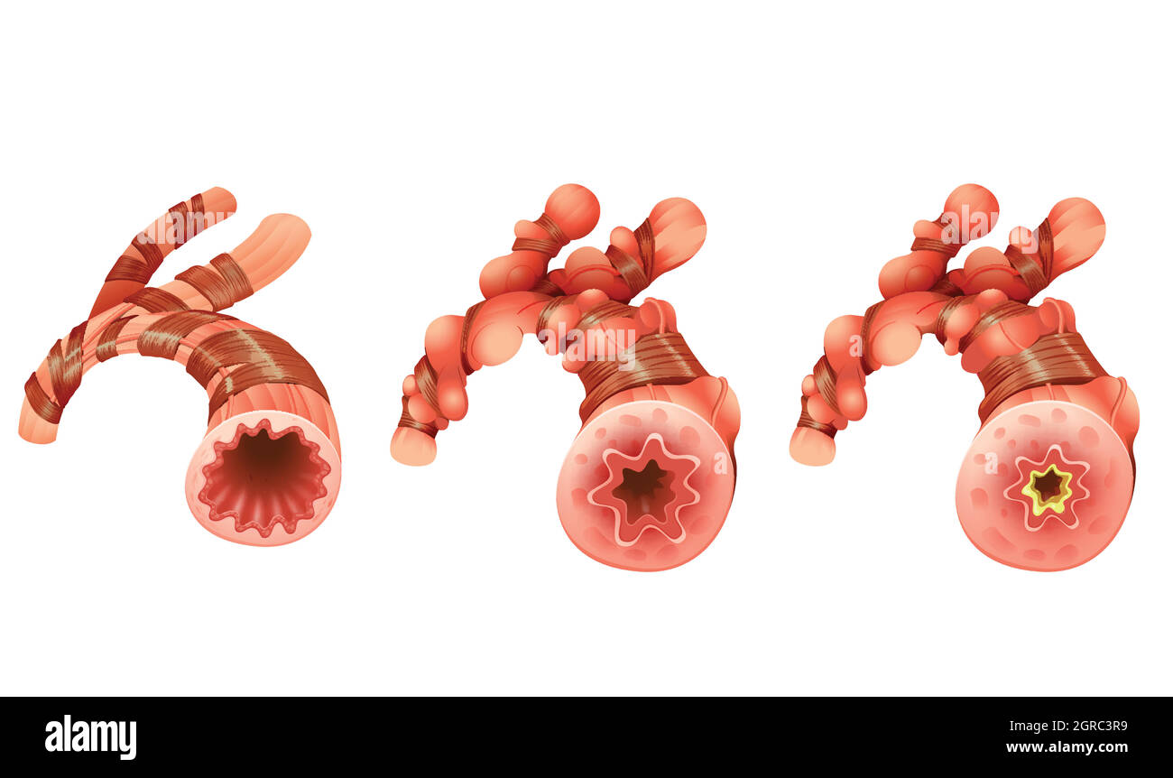 Close up diagram of blood vessel Stock Vector