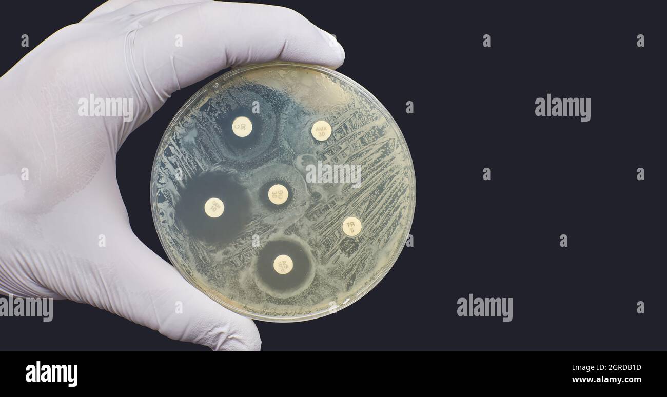 Antibiogram Kirby Bauer Antimicrobial susceptibility resistance diffusion test  Stock Photo