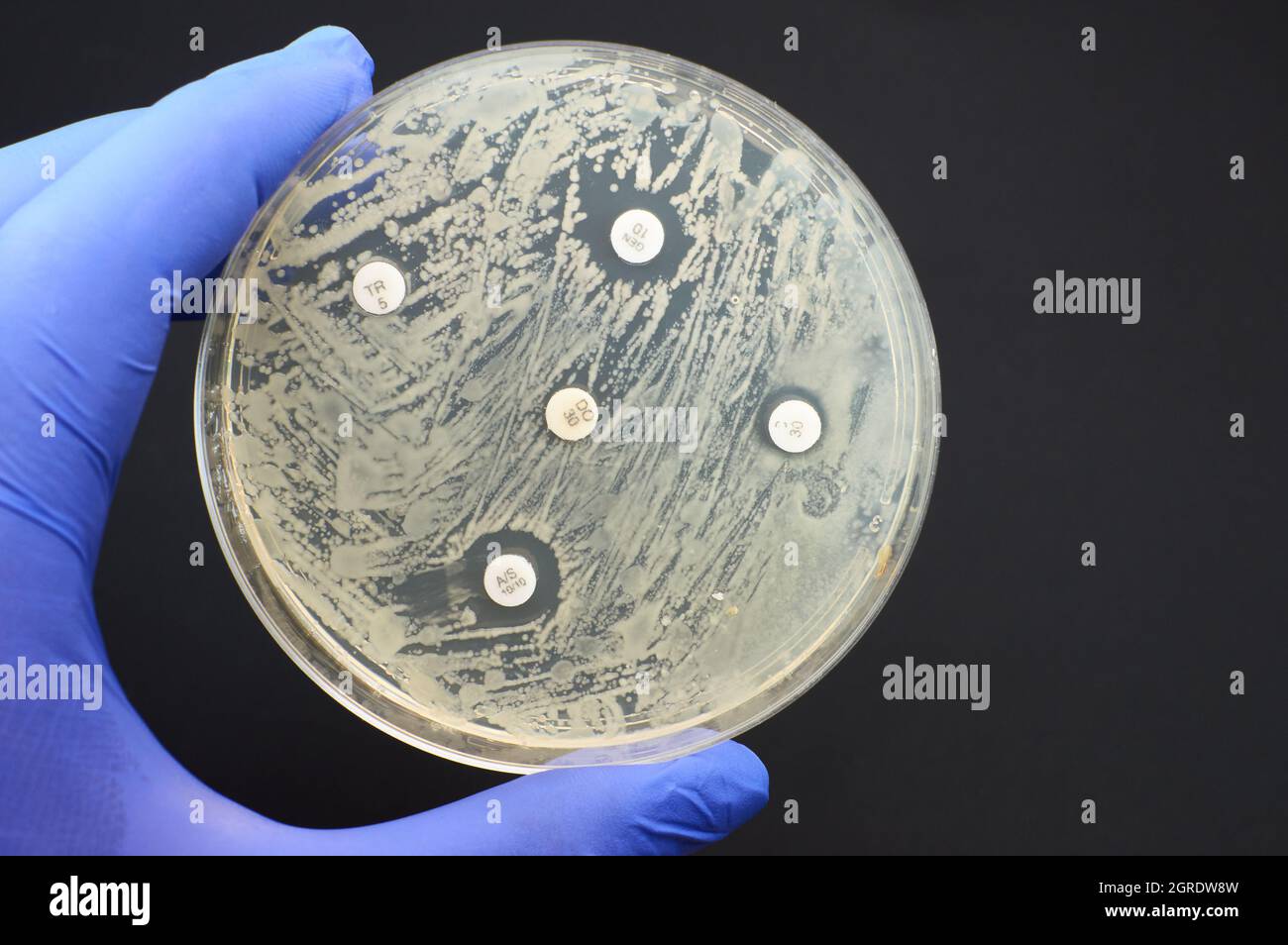 Detecting Antimicrobial Resistance By Kirby Bauer Diffusion Test Stock Photo