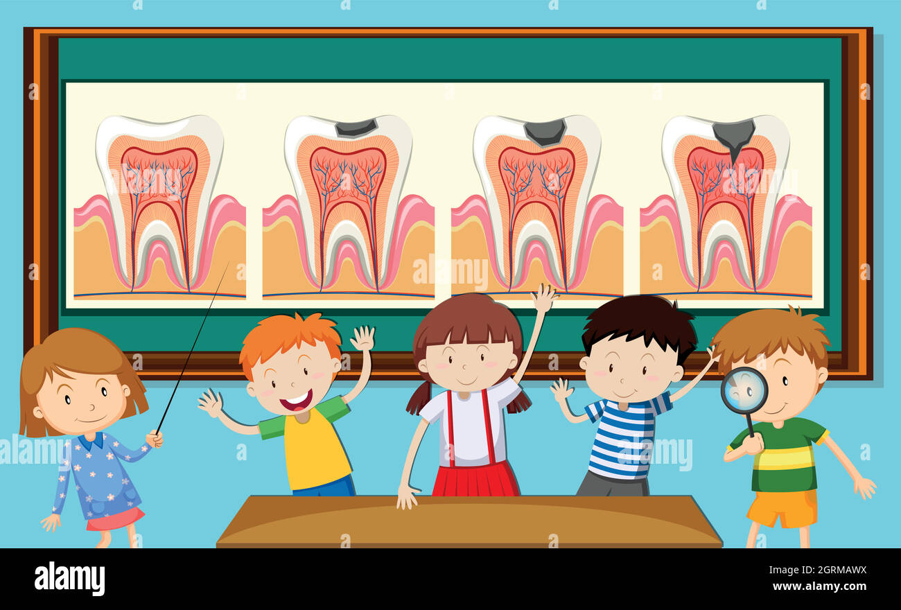 Children and tooth decay diagram Stock Vector