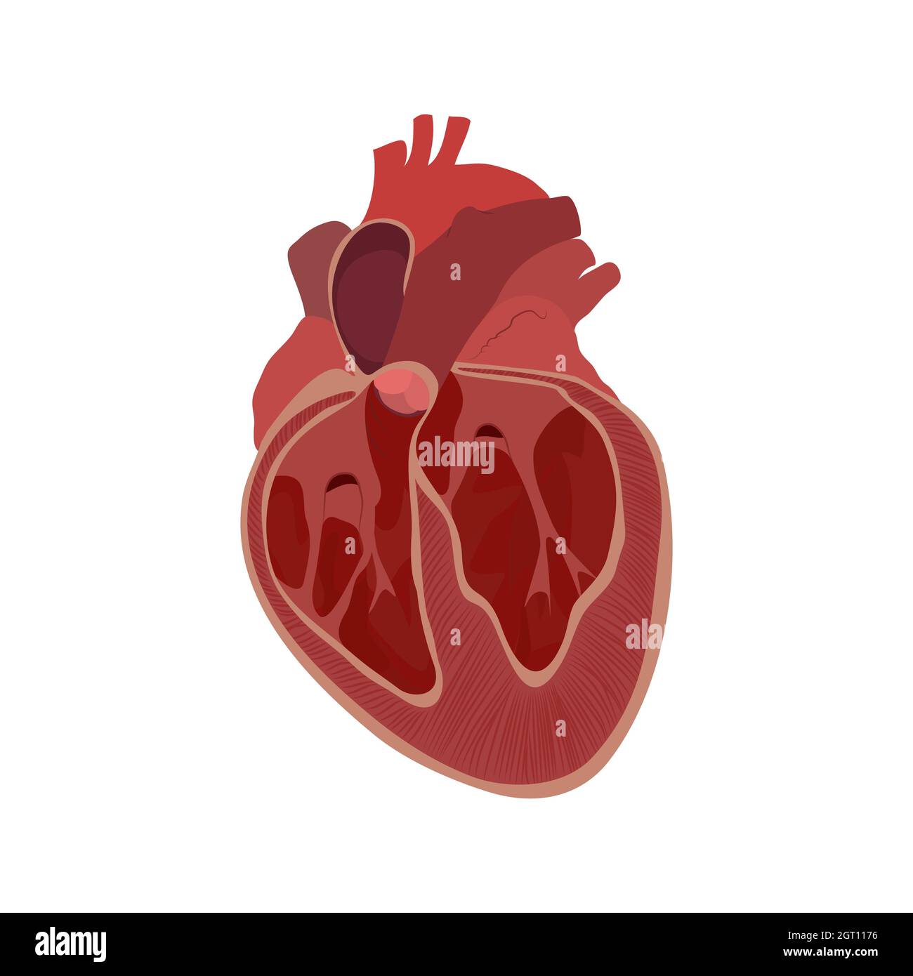 Enlarged heart, illustration Stock Photo