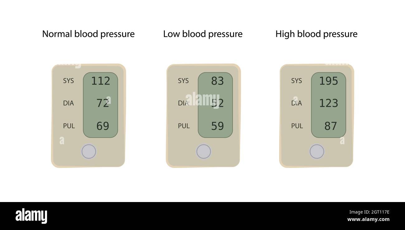 Normal, low and high blood pressures, illustration Stock Photo Alamy
