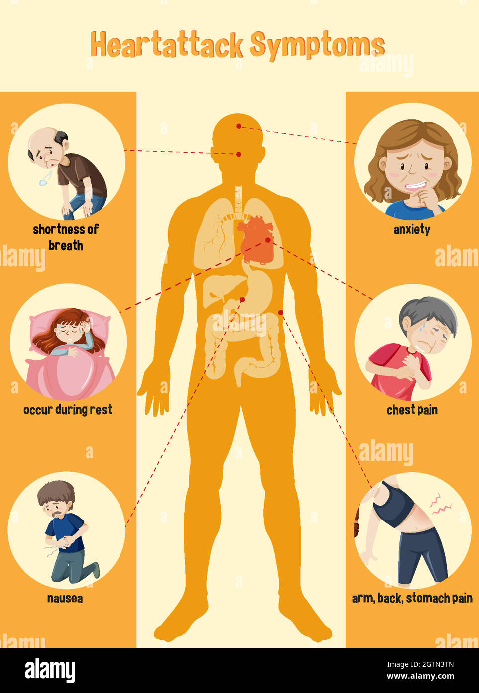 Heart attack Symptoms Information Infographic Stock Vector Image & Art