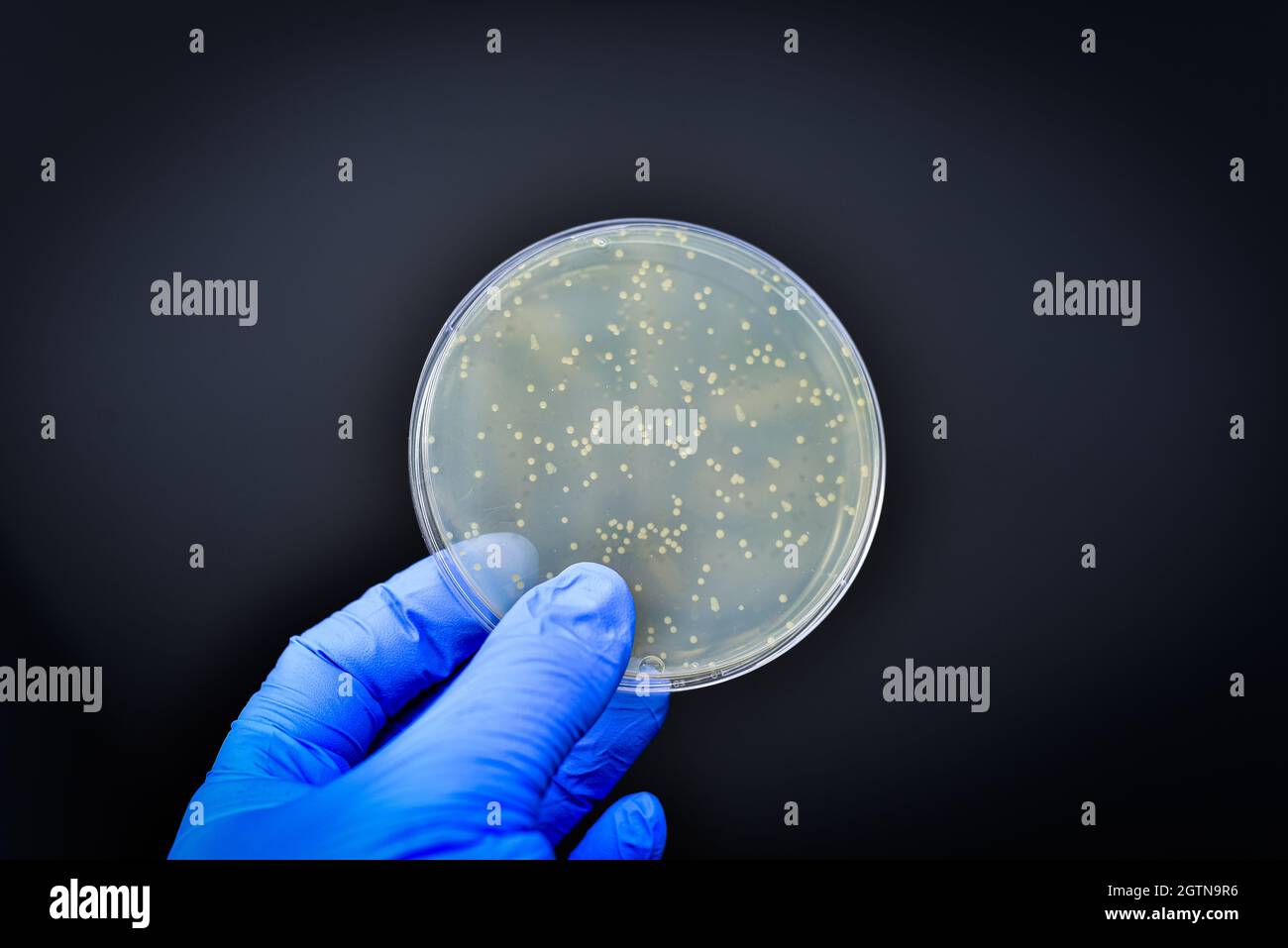 Listeria monocytogenes petri hires stock photography and images Alamy