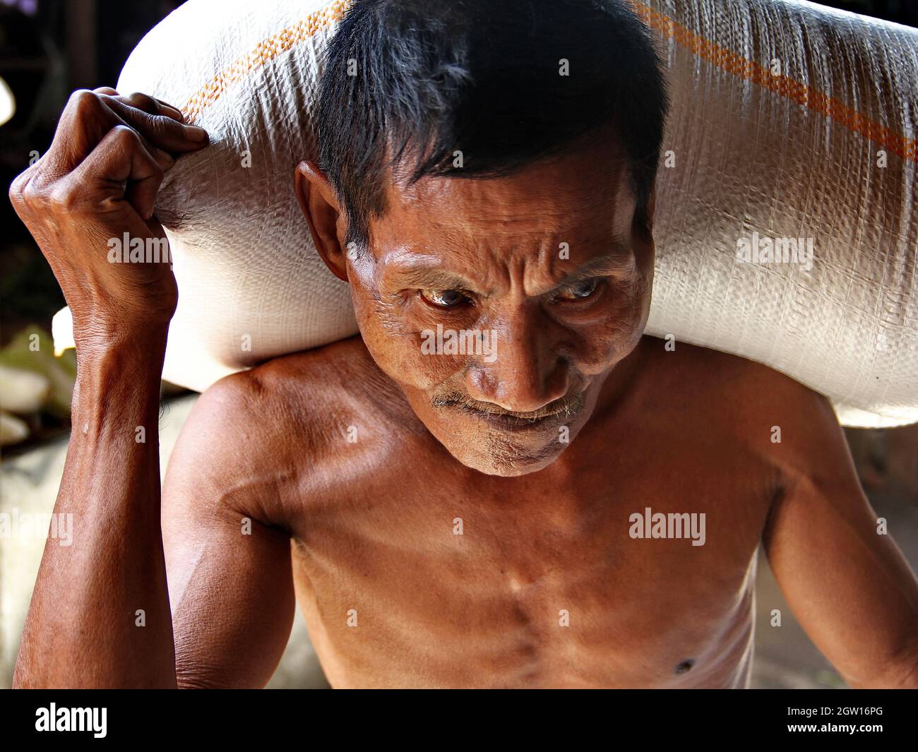 A man with a hair lip carrying a heavy sack of rice in a traditional market in Padang City, West Sumatra, Indonesia. The man has a cleft palate. Stock Photo