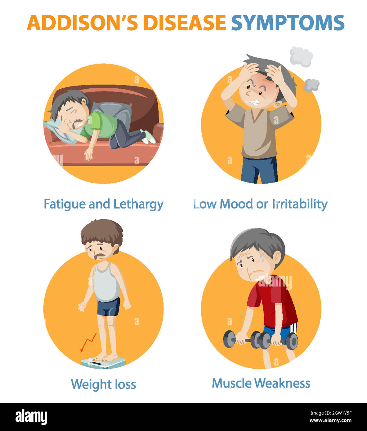 Medical infographic of Addison's disease symptoms Stock Vector Image
