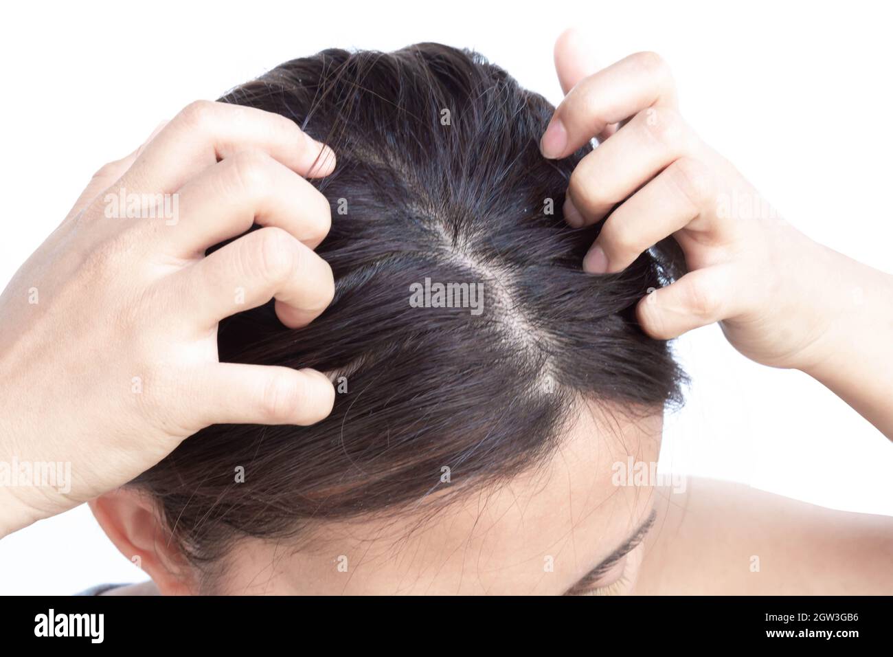 Woman Scratching Head Against White Background Stock Photo