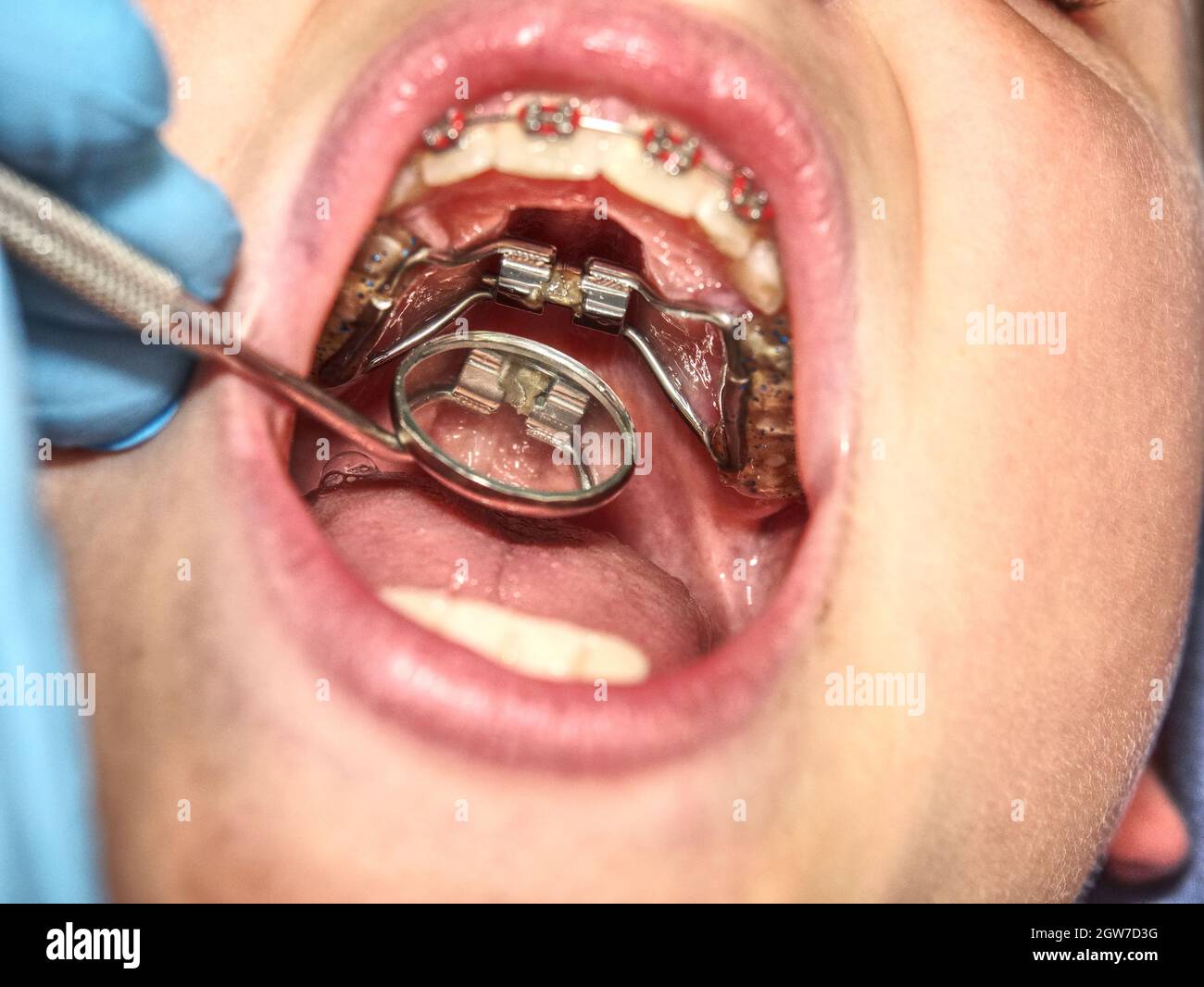 Banded hyrax expander hires stock photography and images Alamy