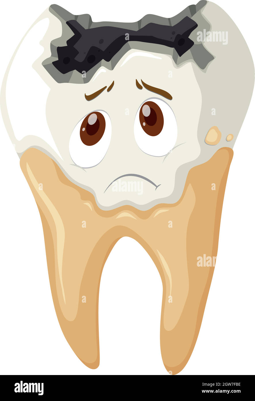 Tooth decay with sad face Stock Vector