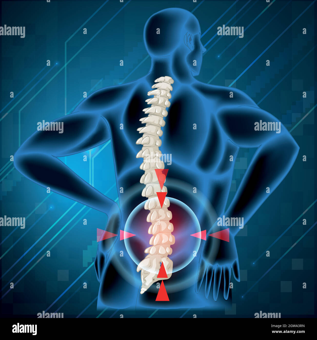 Spine bone showing back pain Stock Vector