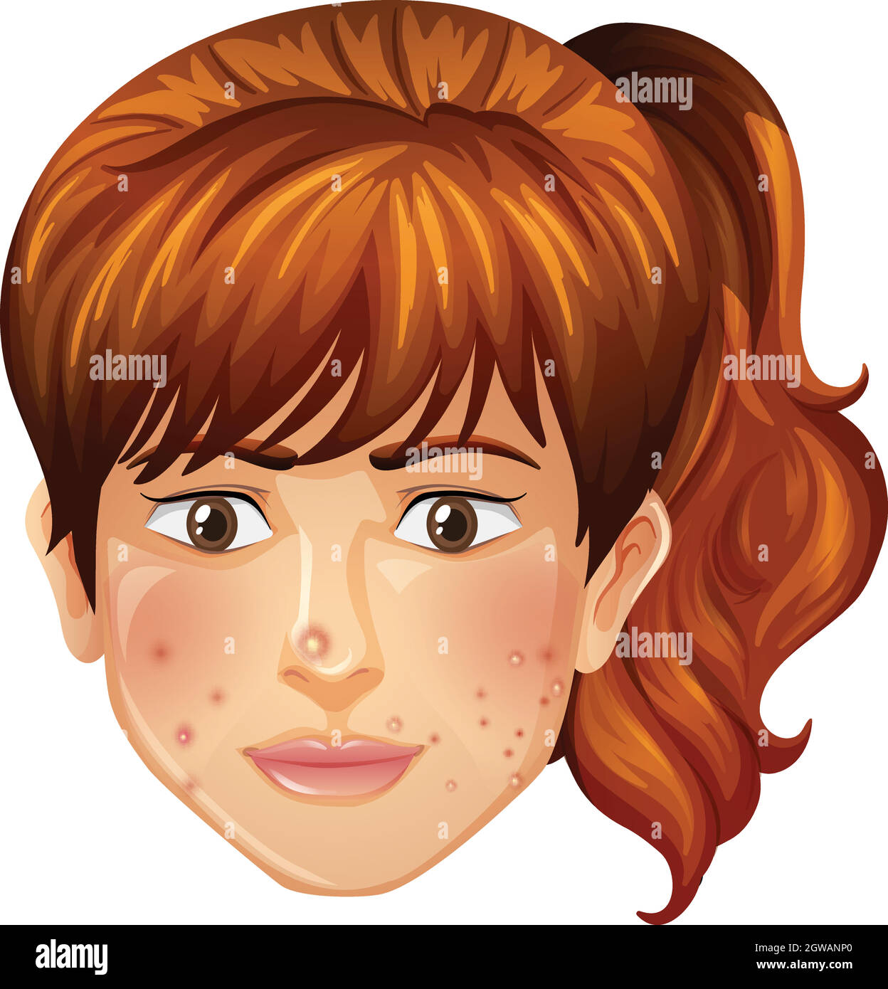 A Girl with Pimples Problem Stock Vector