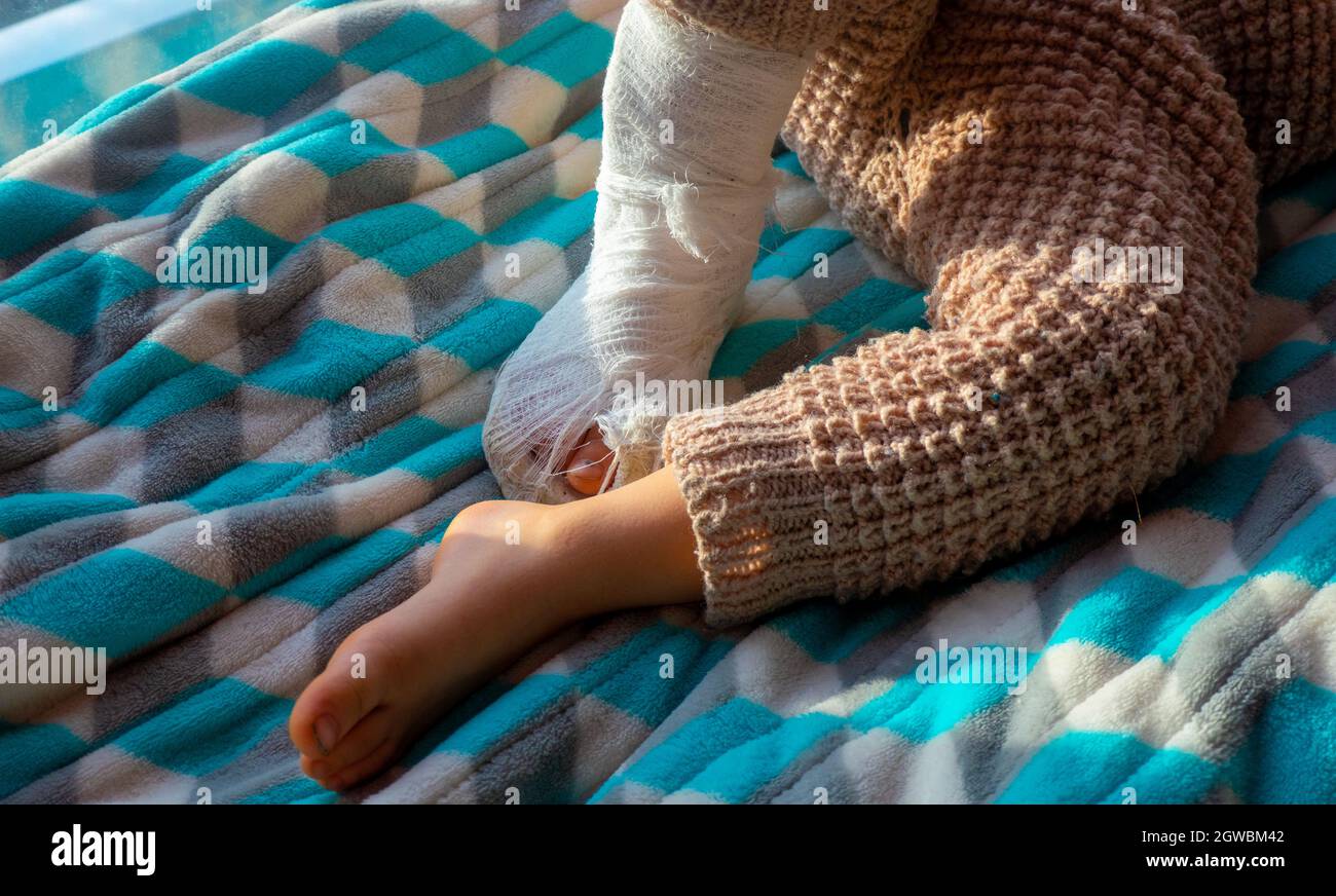 Child with bandage on leg heel fracture. Broken right foot, bone, calf