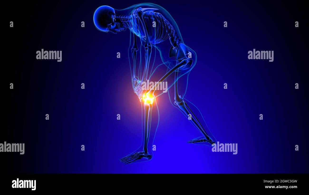 Knee joint pain Anatomy For Medical Concept 3D Illustration Stock Photo Alamy