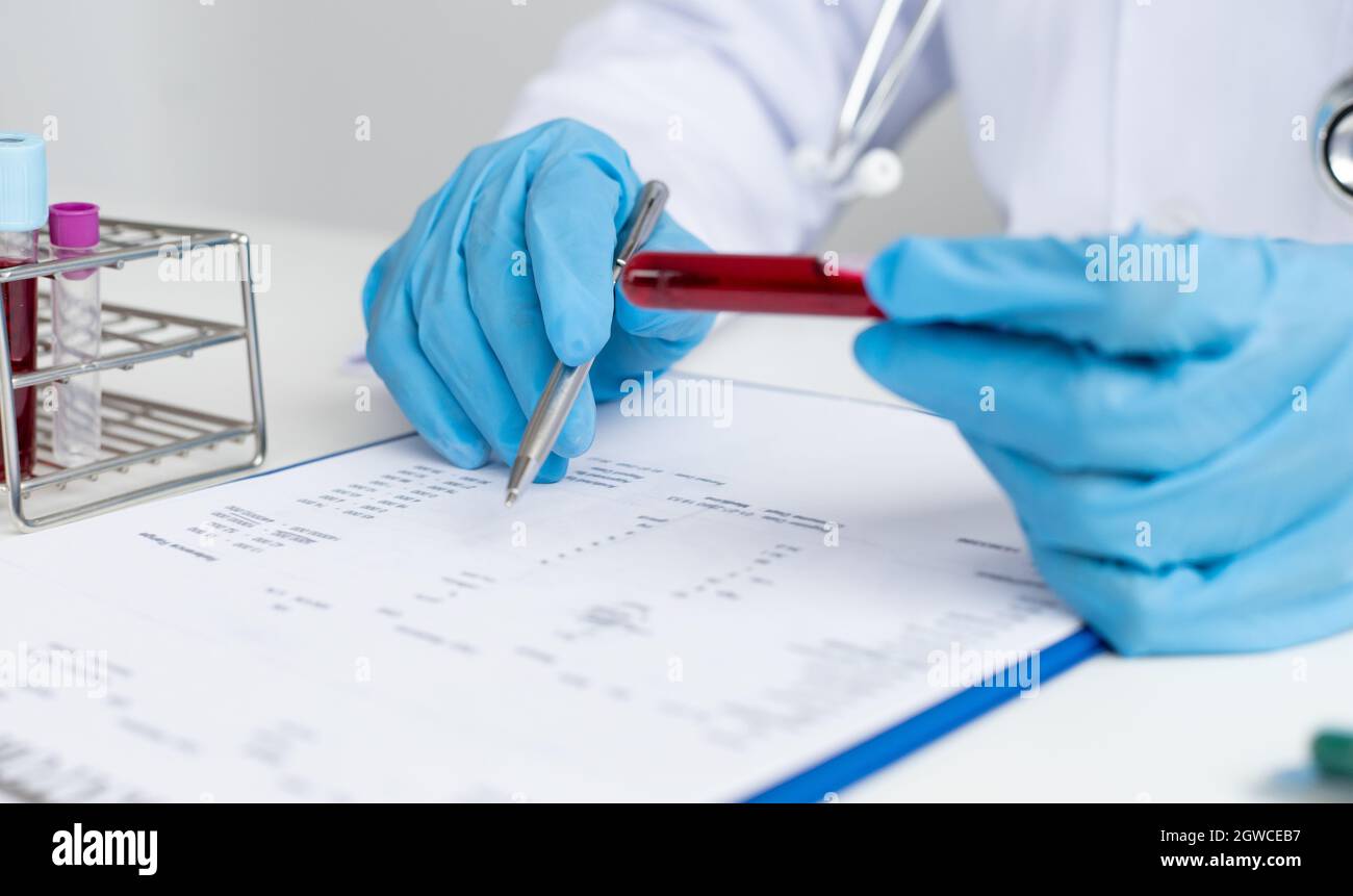 In Vitro Testing Sample Diagnostic in vitro hi-res stock photography and images - Alamy